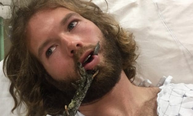 Puisqu’on vous répète de ne pas confondre nociception et douleur !