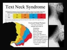 Text neck et neck pain