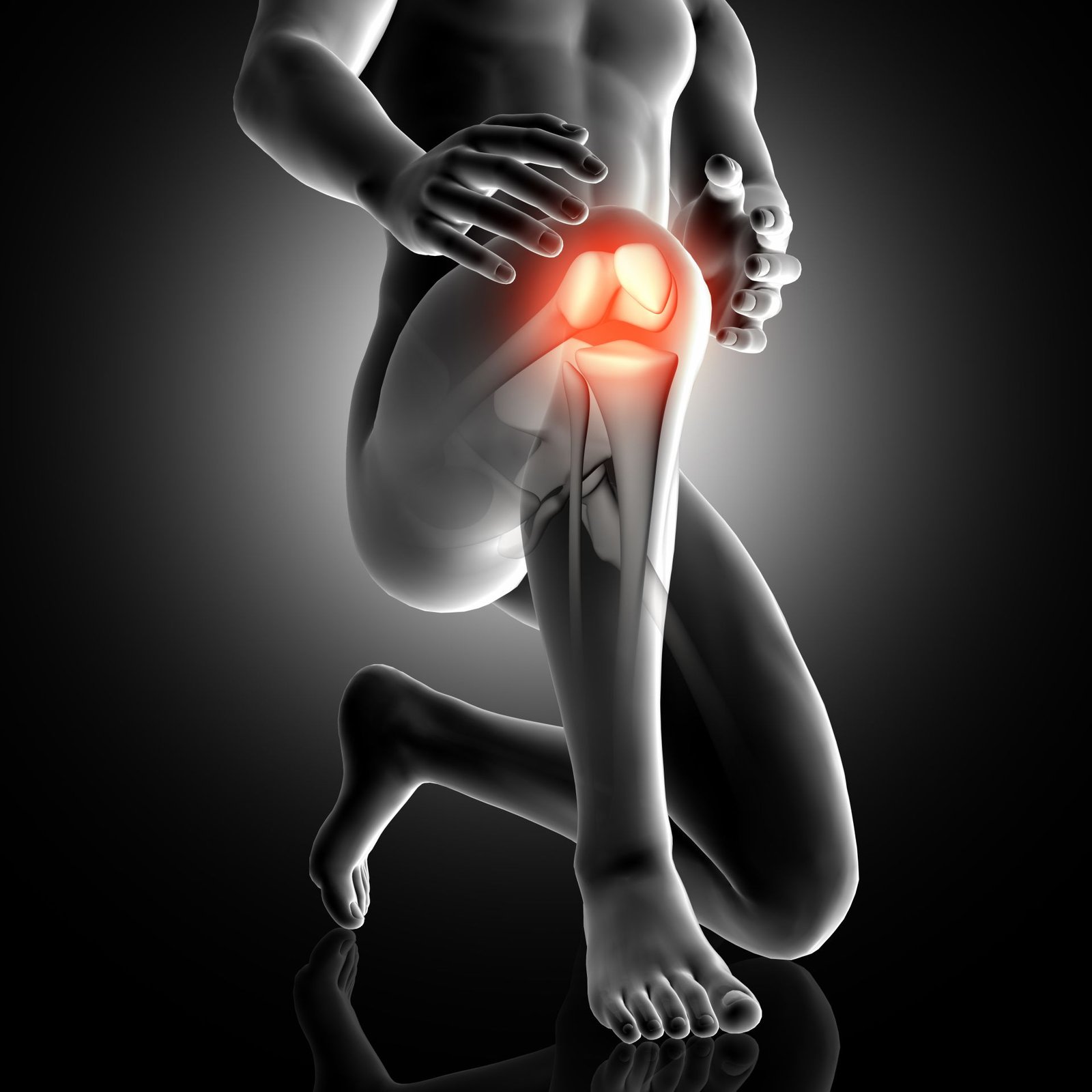 Fractures du genou
