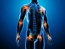 Tendinopathies et sensibilisation centrale