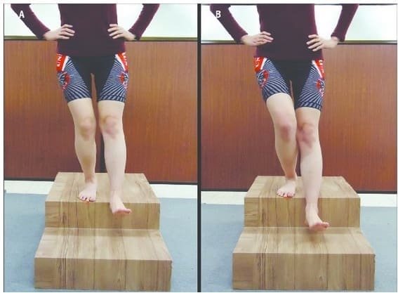 Facteur prédictifs de la douleur des facialites plantaires