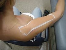 McConnell Taping et Conflit sous-acromial