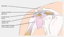 Conflit sous-acromial: stratégie spécifique d