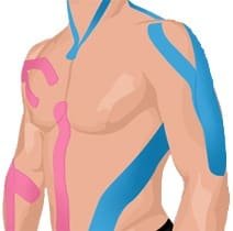 Kinesiotaping: Magic-tape ou placebo-tape ?