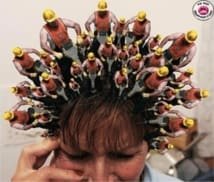 Céphalées cervicogéniques et articulation temporomandibulaire