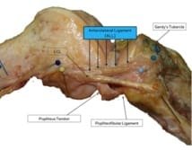 Le ligament antéro-latéral et la stabilité du genou