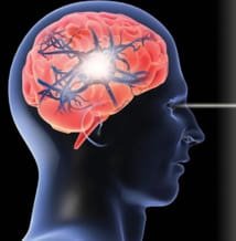 Congrès Observation et Imagerie Motrice 2014 (4)