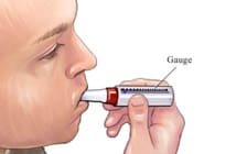 La toux chez le patient neuromusculaire