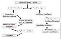 Quelle stratégie thérapeutique devant une toux inefficace chez le patient neuromusculaire ?