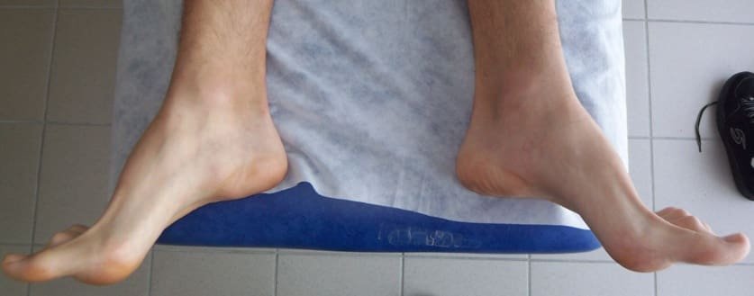 Le pied du grimpeur : une entité délaissée? 