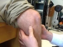 Les tests méniscaux : une revue systématique et méta-analyse