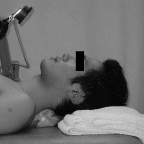 Efficacité des exercices pour les cervicalgies chroniques 