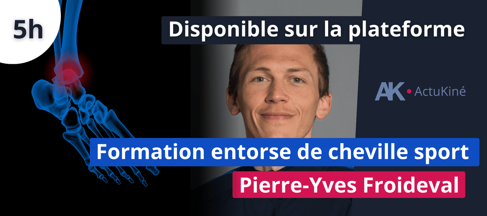Formation entorse de cheville sport Pierre-Yves Froideval kiné