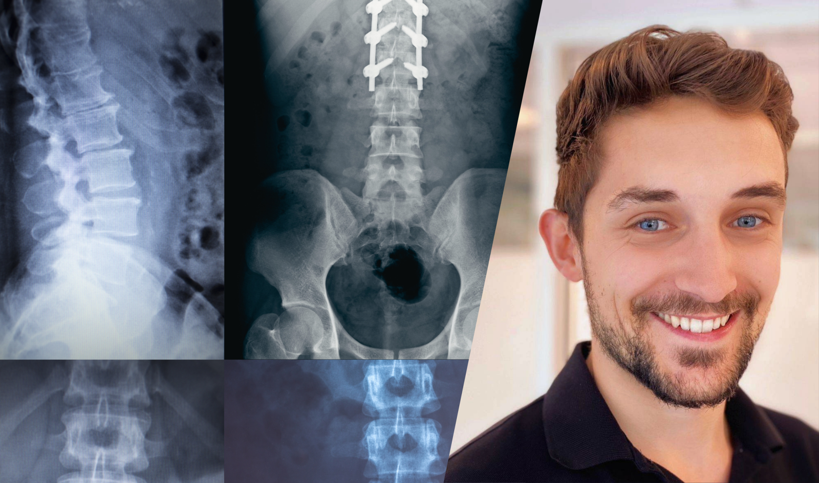 Comprendre l&rsquo;imagerie lombaire pour faire passer votre traitement à la vitesse supérieure