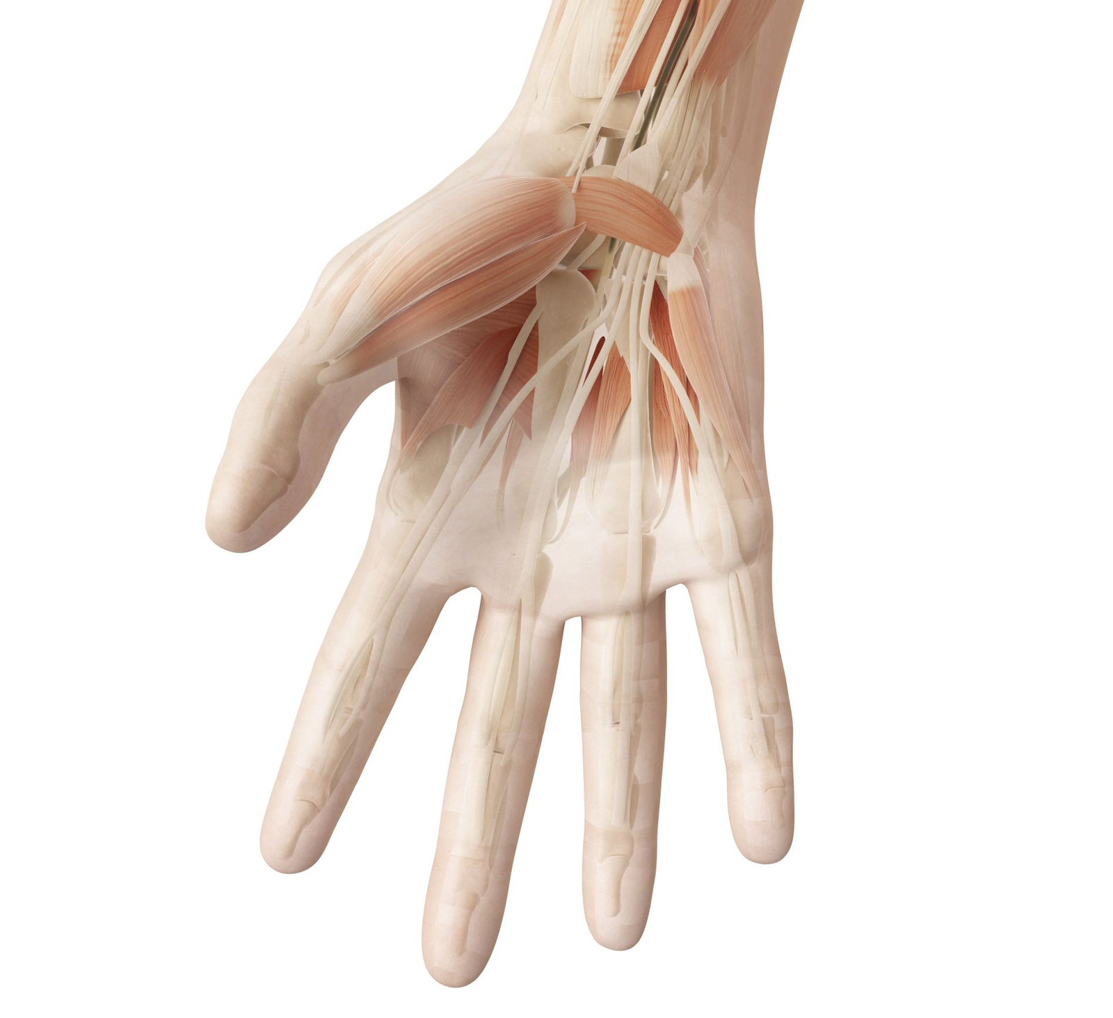 Arthrose de la main