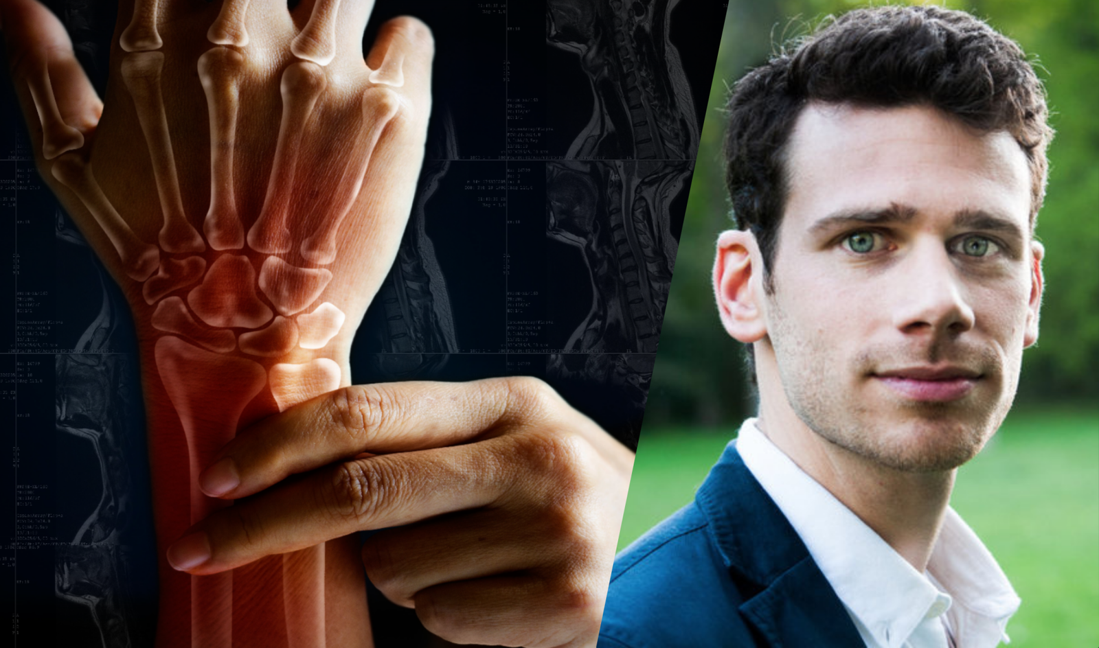 Pathologies rhumatismales inflammatoires : connaissances actuelles pour reconnaître, évaluer et accompagner les patients